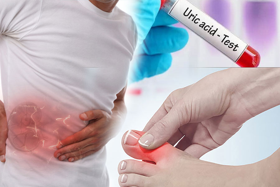axit uric cao cần ăn ít 5 loại thực phẩm