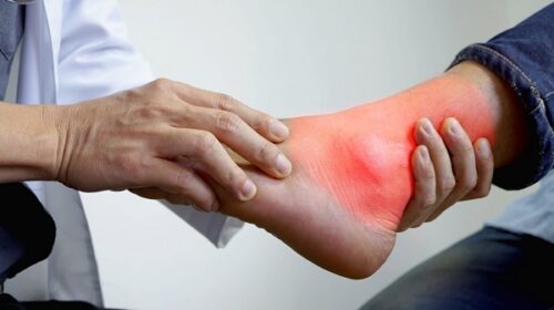 Các dấu hiệu và triệu chứng của bệnh gút hầu như luôn xảy ra đột ngột, thường xảy ra vào ban đêm