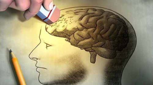béo làm tăng nguy cơ mắc bệnh thoái hóa thần kinh