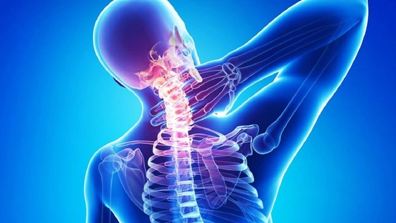thoái hóa đốt sống cổ
