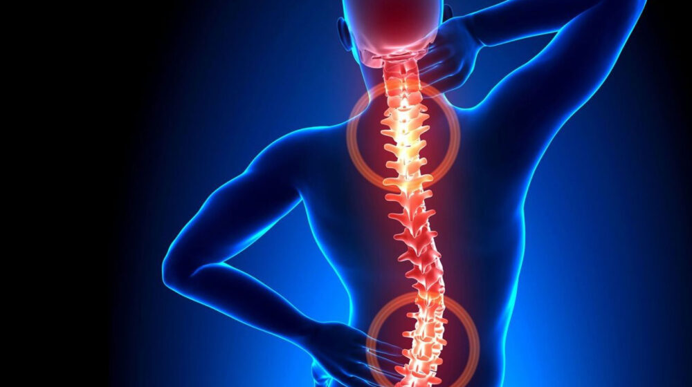triệu chứng thoát vị đĩa đệm
