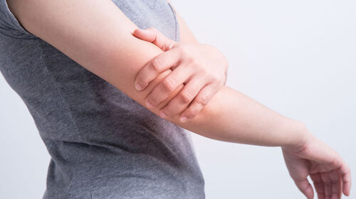 mỡ cánh tay xác định sức khỏe xương cột sống