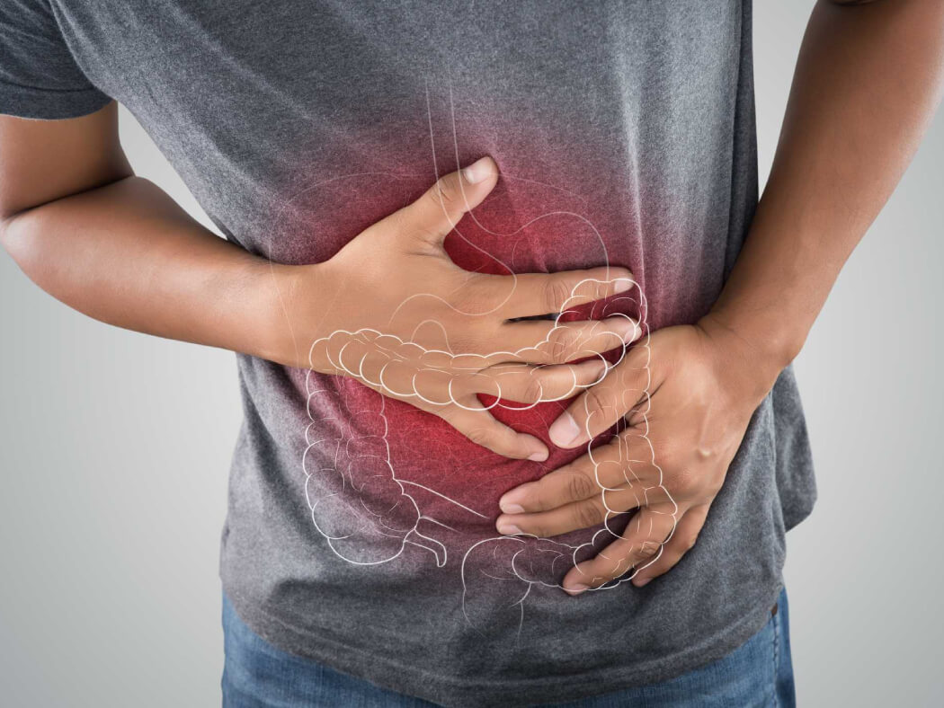 mối liên hệ giữa ung thư đại tràng và thịt đỏ, thịt chế biến sẵn