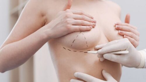nâng ngực cải thiện đời sống tình dục và sức khỏe tinh thần