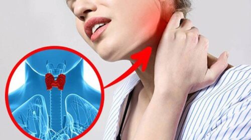 triệu chứng ung thư tuyến giáp