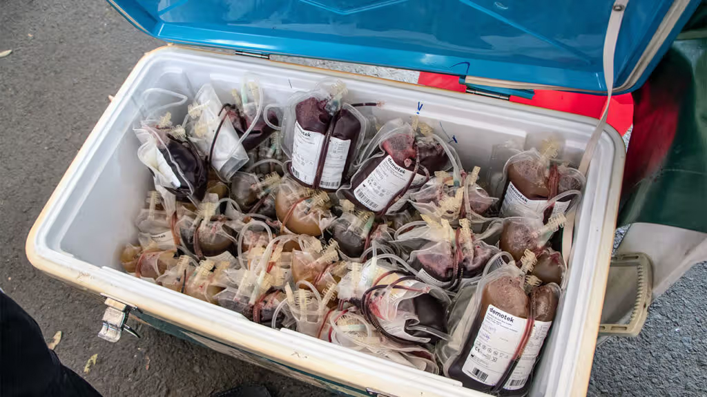 xét nghiệm máu đồng hồ tuổi proteomic phát hiện bệnh