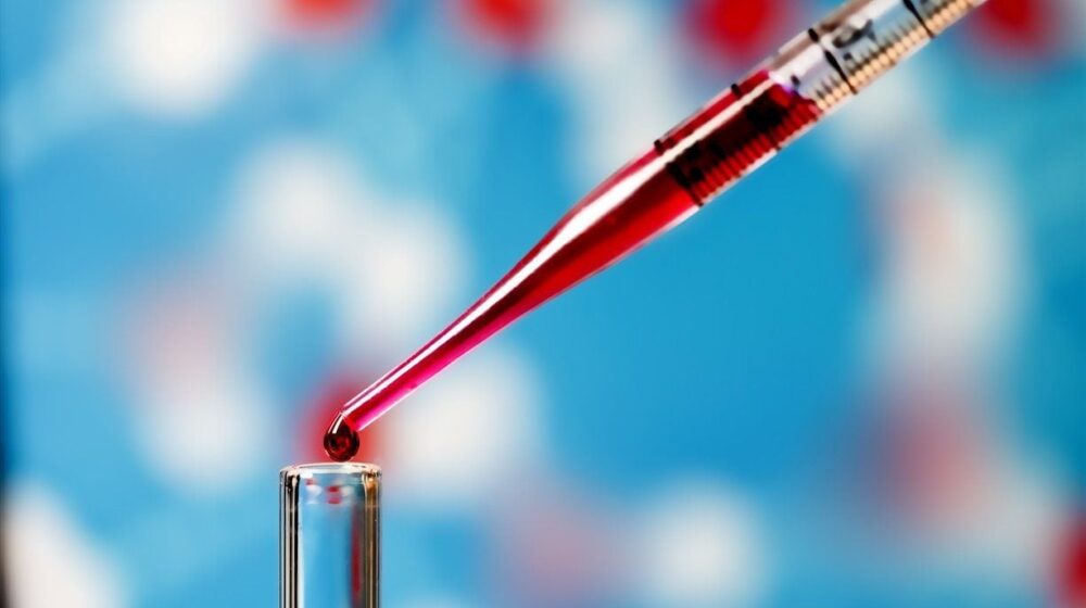 xét nghiệm máu đồng hồ tuổi proteomic phát hiện bệnh