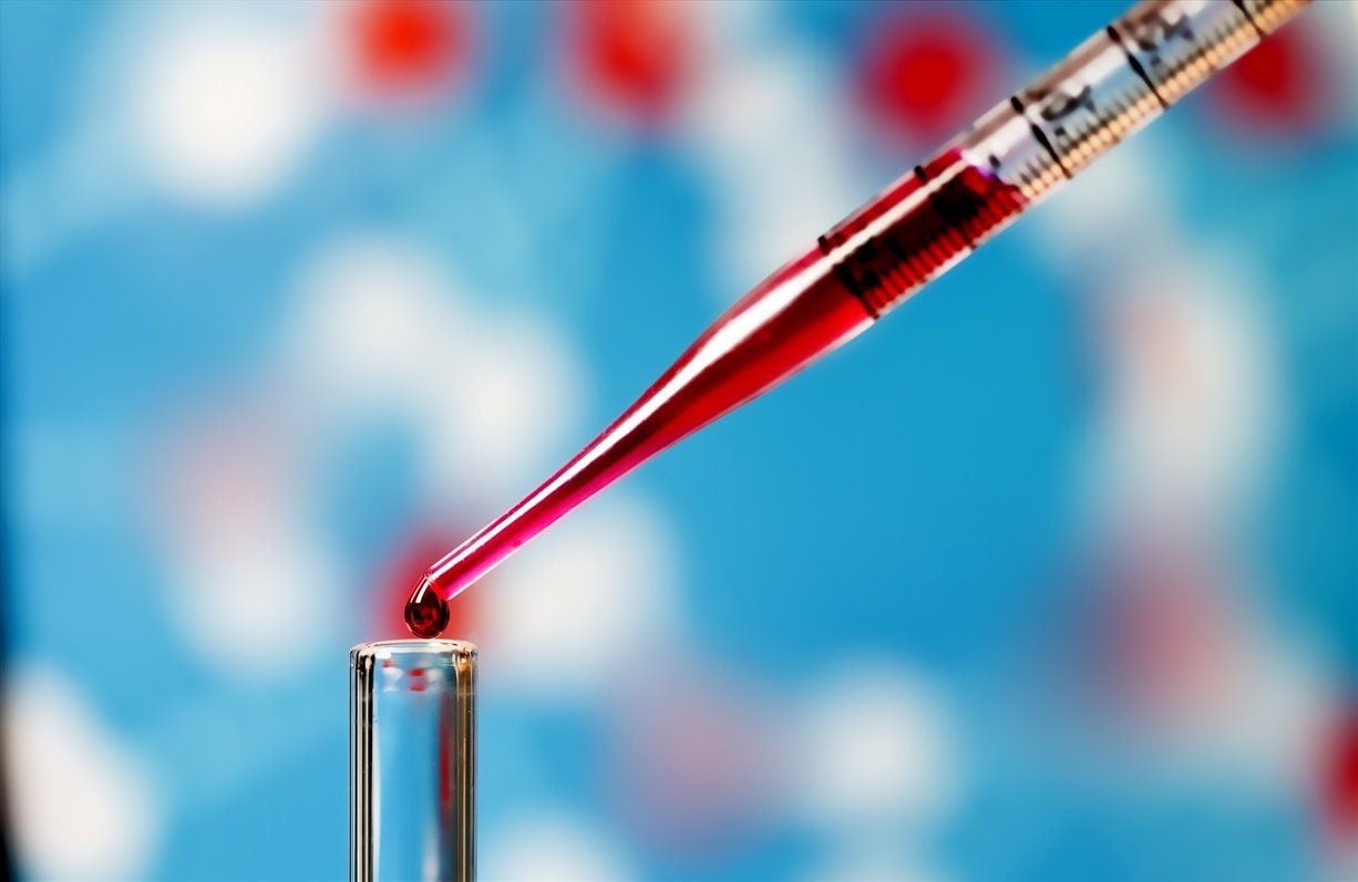 xét nghiệm máu đồng hồ tuổi proteomic phát hiện bệnh