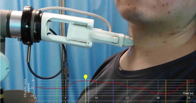 AI siêu âm tuyến giáp yducothainguyen