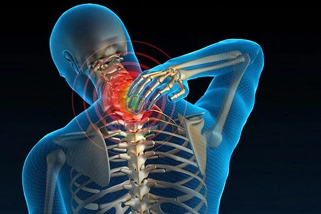 đau cổ hậu covid phải làm gì