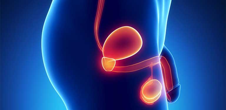 dấu hiệu ung thư tinh hoàn yduocthainguyen