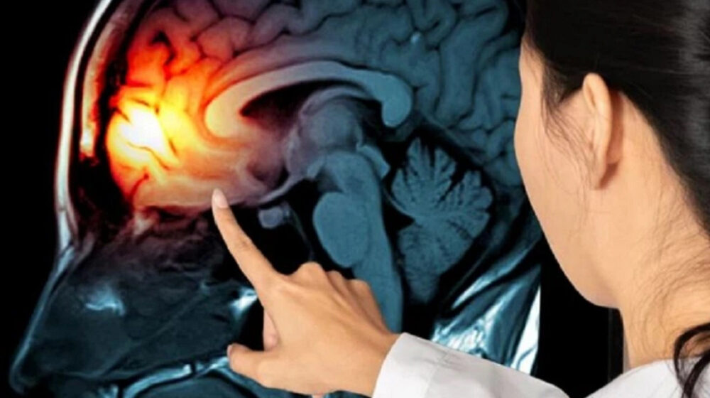 u não triệu chứng của bệnh nguyên nhân gây bệnh