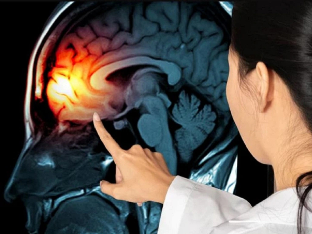 u não triệu chứng của bệnh nguyên nhân gây bệnh