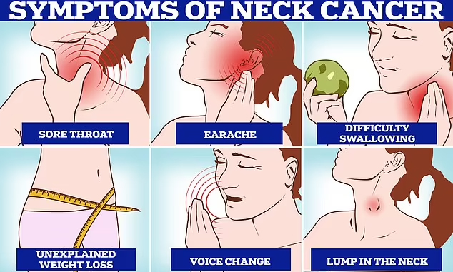 vệ sinh răng miệng kém tăng nguy cơ ung thư đầu cổ