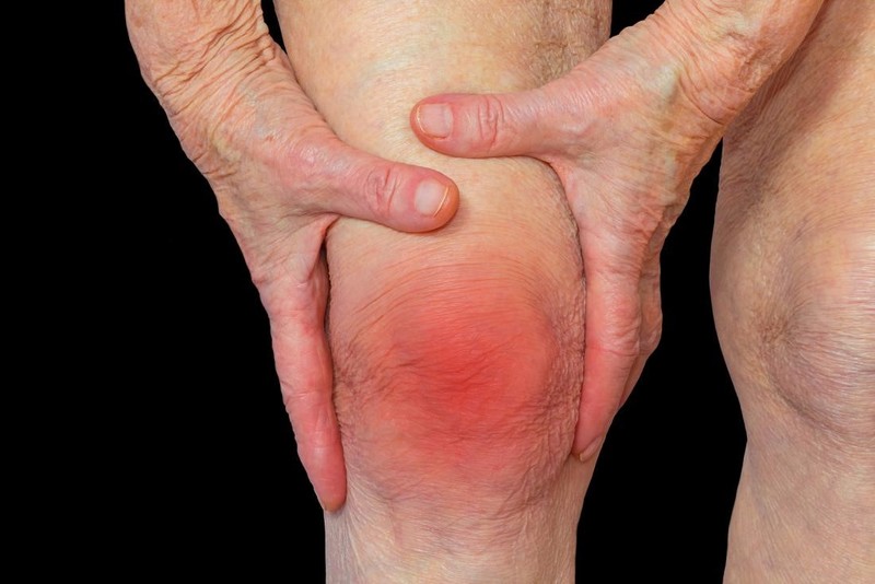 Viêm khớp dạng thấp và bệnh tim mạch yduocthainguyen
