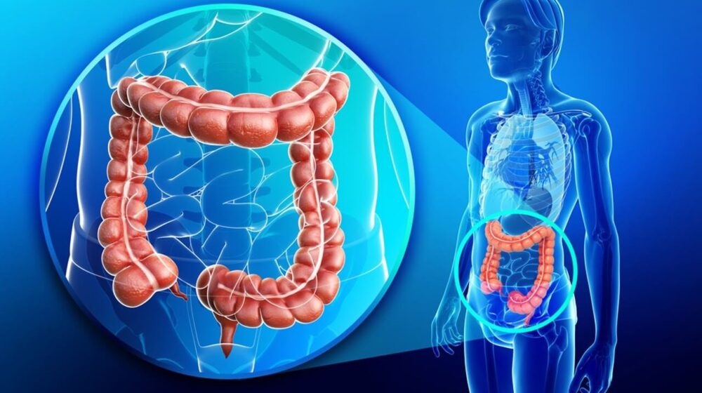 thiếu sắt cảnh báo ung thư đại trực tràng ở người trẻ y duoc thai nguyen