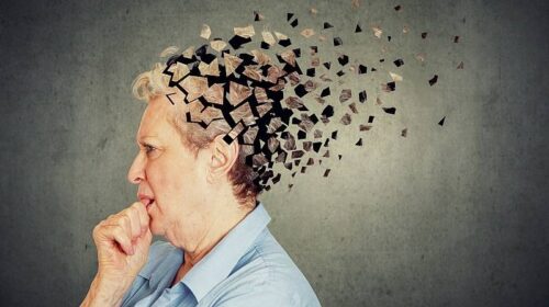 Đau khớp và căng thẳng kéo dài dẫn đến Alzheimer
