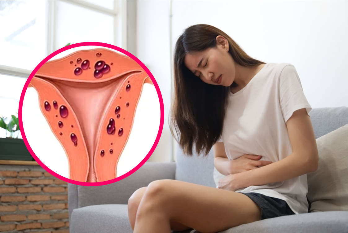 uống nhiều kẽm làm tăng nguy cơ lạc nội mạc tử cung y duoc thai nguyen