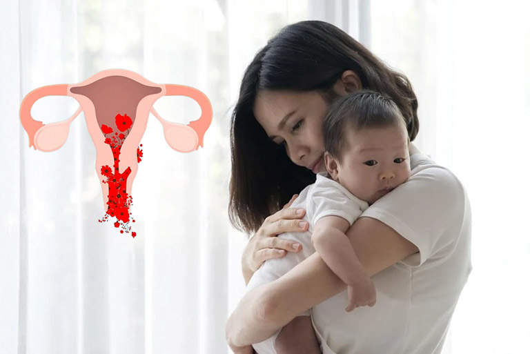 cây cứt lợn chữa bệnh phụ nữ y duoc thai nguyen