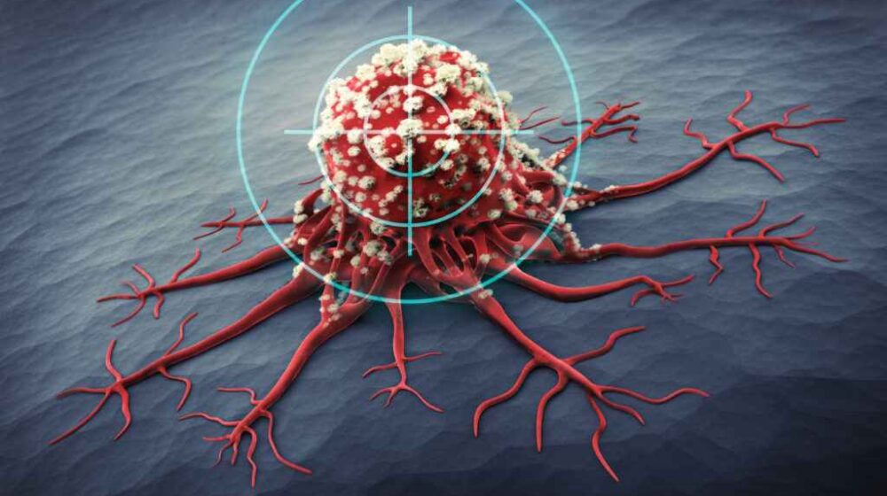 FDA phê duyệt thuốc kháng thể kép đột phá trong điều trị ung thư tuyến tụy và ung thư phổi