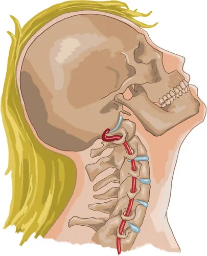 đột quỵ tiệm làm đẹp y duoc thai nguyen