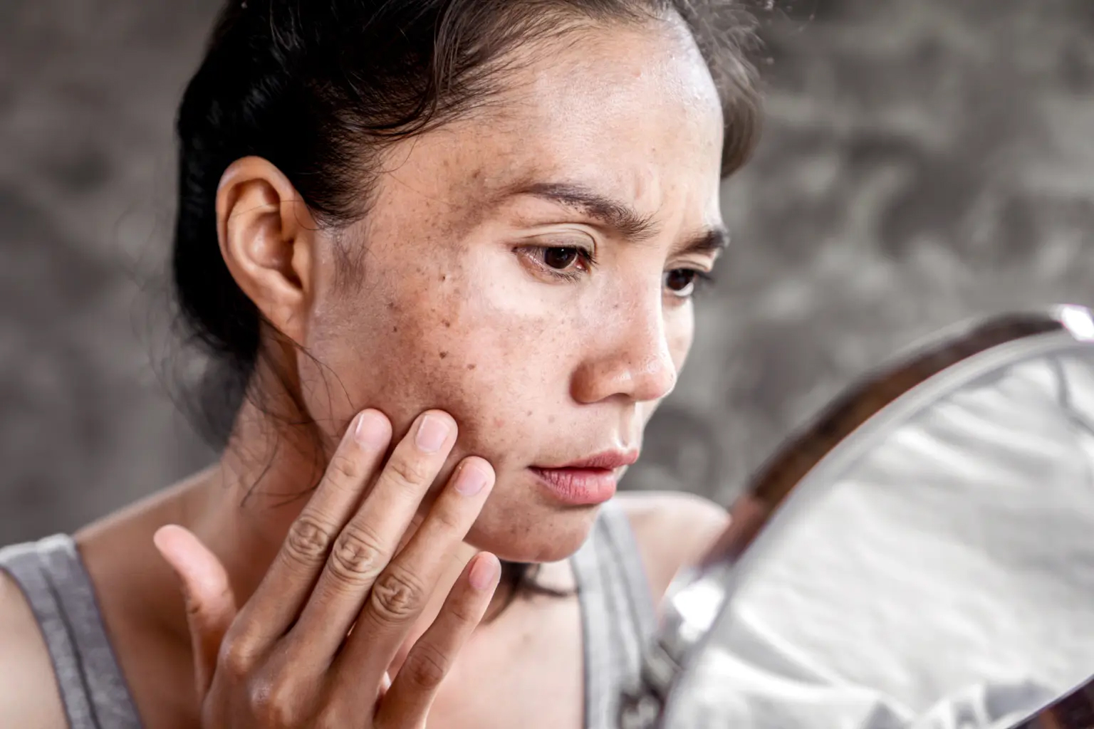 cảnh báo loại thuốc làm tăng nguy cơ ung thư da y duoc thai nguyen