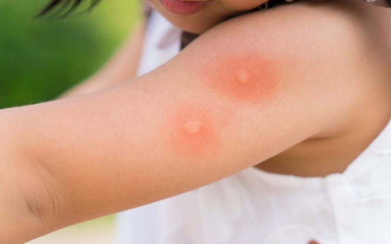 hạ khô thảo chữa đau nhức lở loét mụn nhọt y duoc thai nguyen