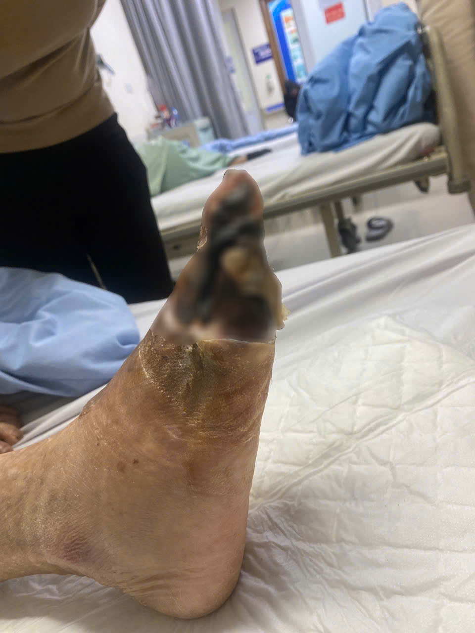 tưởng bệnh xương khớp hóa ra bị viêm tắc tĩnh mạch y duoc thai nguyen