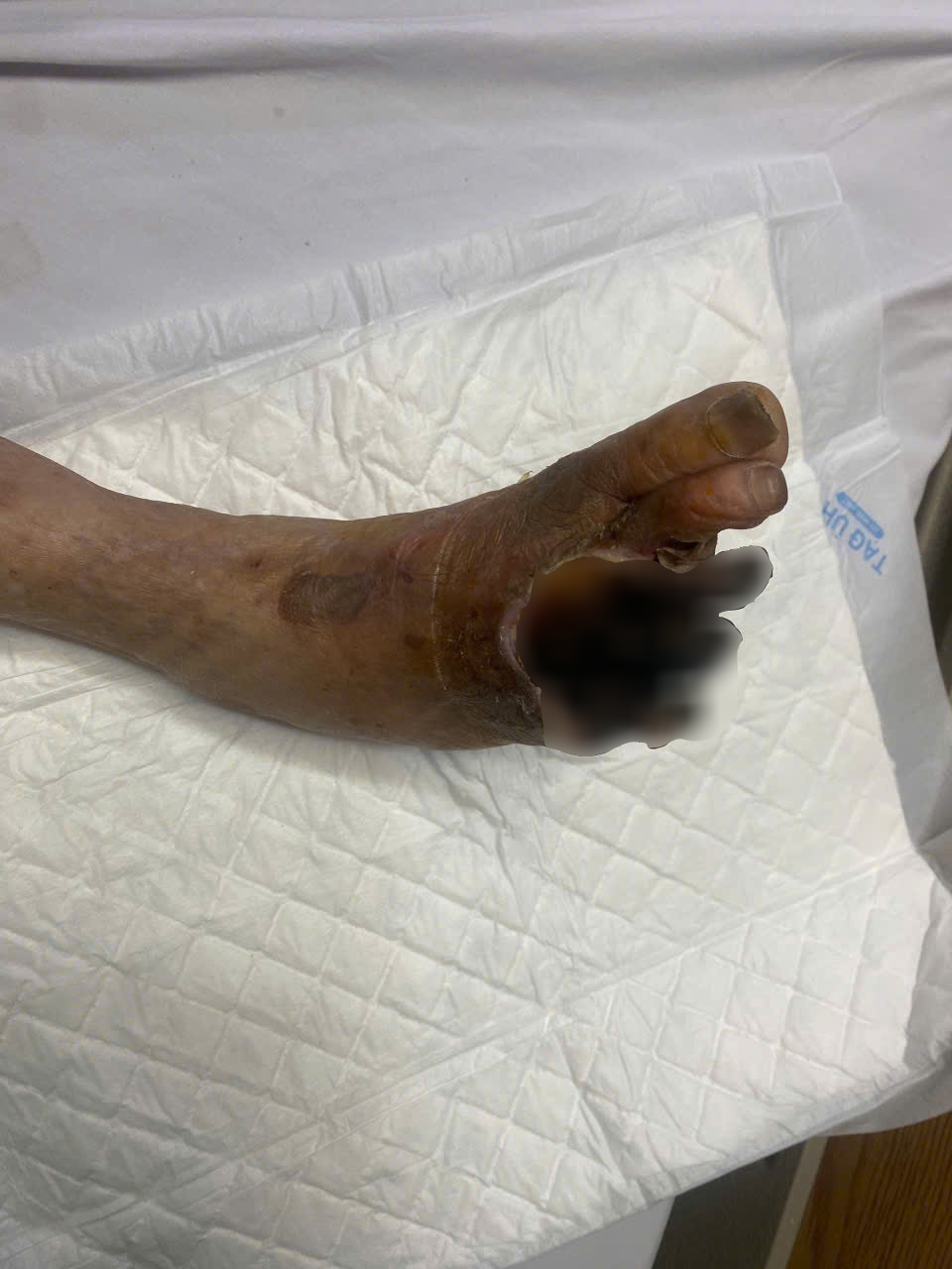 tưởng bệnh xương khớp hóa ra bị viêm tắc tĩnh mạch y duoc thai nguyen