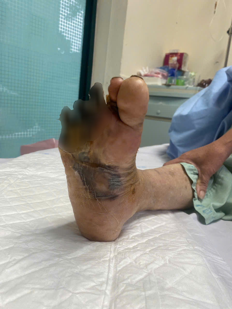 tưởng bệnh xương khớp hóa ra bị viêm tắc tĩnh mạch y duoc thai nguyen