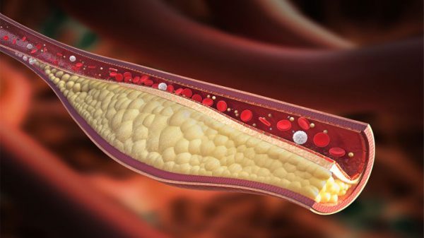 nước ép lựu giảm bệnh tim mạch y duoc thai nguyen