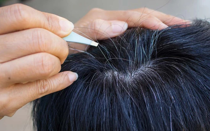 thiếu hụt đồng khiến tóc bạc sớm y duoc thai nguyen