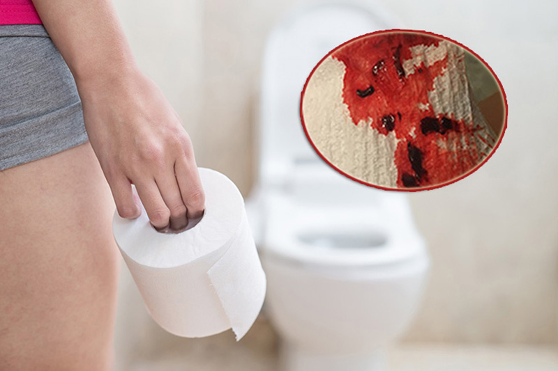 dấu hiệu ung thư ruột ở người trẻ y duoc thai nguyen