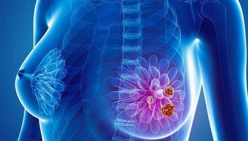 dầu gội mỹ phẩm chứa hóa chất độc hại làm tăng ung thư vú y duoc thai nguyen