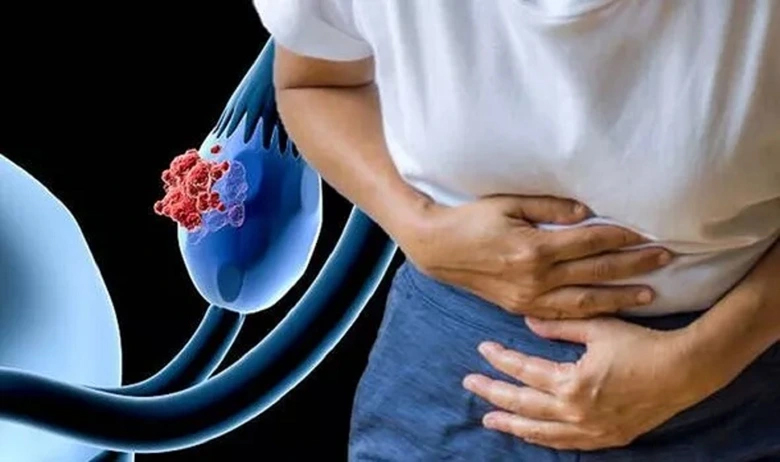 điều trị ung thư buồng trứng thanh dịch y duoc thai nguyen