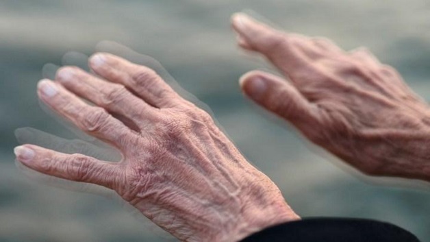 sống gần sân golf làm tăng nguy cơ mắc bệnh Alzheimer y duoc thai nguyen