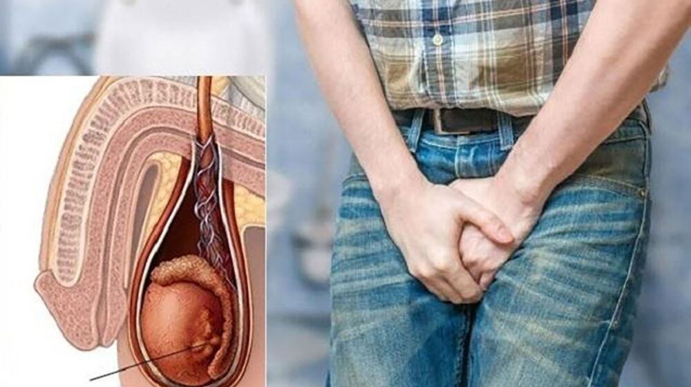 phát hiện ung thư tinh hoàn sau tắm y duoc thai nguyen