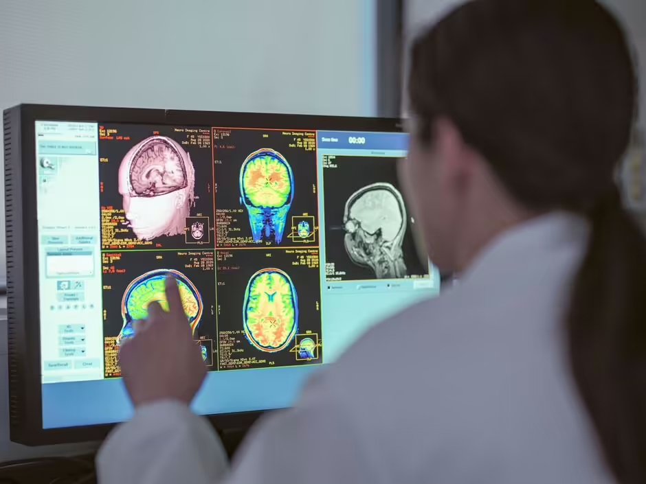 thuốc điều trị ung thư đảo ngược Alzheimer y duoc thai nguyen