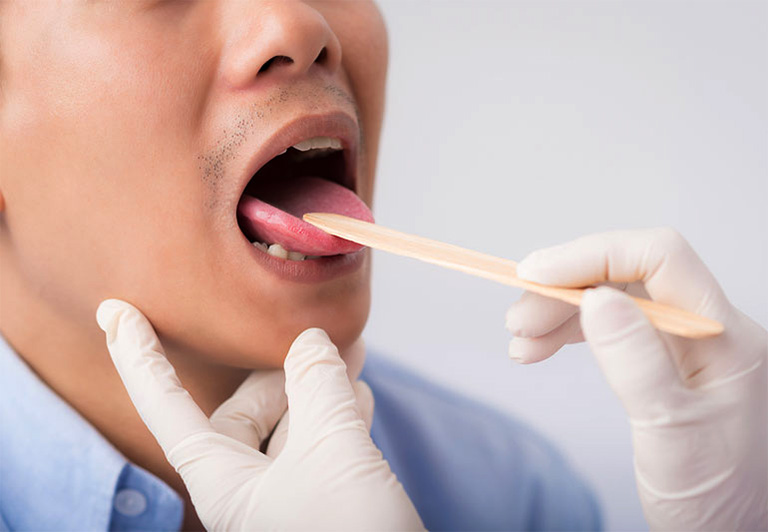 bấm huyệt giảm đau lưỡi y duoc thai nguyen