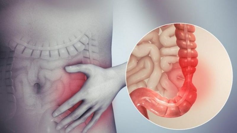 dấu hiệu đau do ung thư đại tràng y duoc thai nguyen