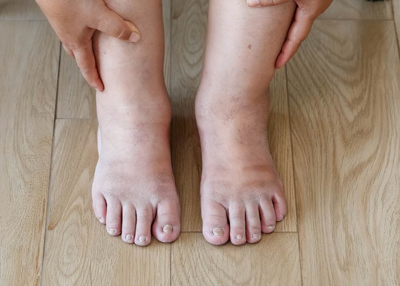 xoa bóp đầu gối trước khi ngủ y duoc thai nguyen