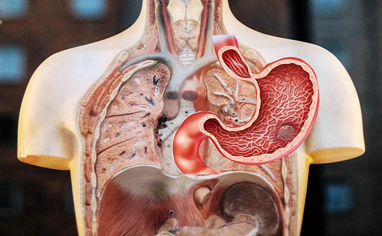 yếu tố tăng nguy cơ ung thư dạ dày y duoc thai nguyen