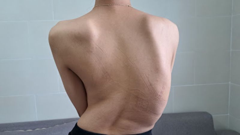 dấu hiệu loãng xương y duoc thai nguyen