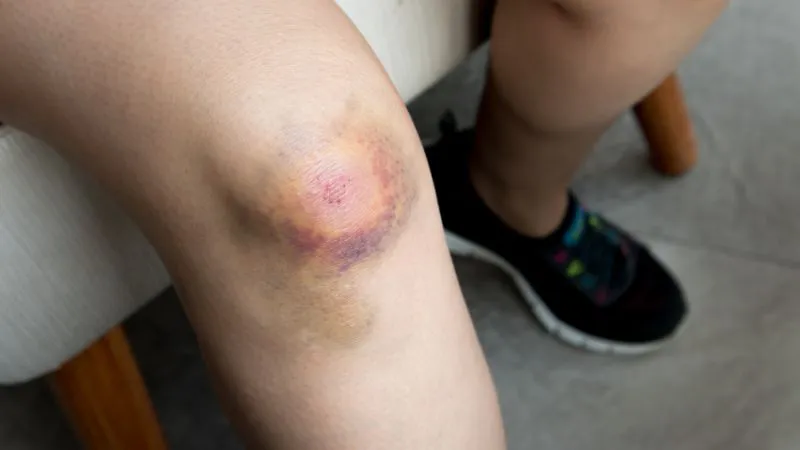 dấu hiệu ung thư thầm lặng ở phụ nữ y duoc thai nguyen