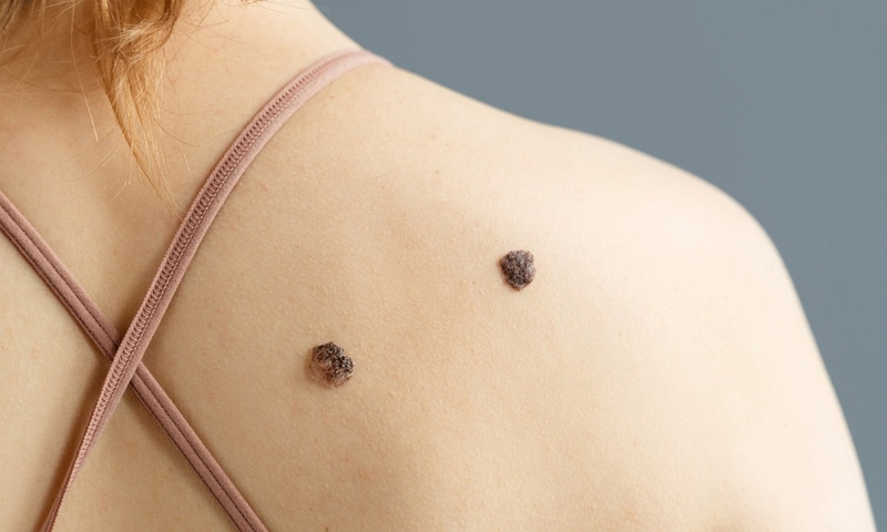 dấu hiệu ung thư thầm lặng ở phụ nữ y duoc thai nguyen