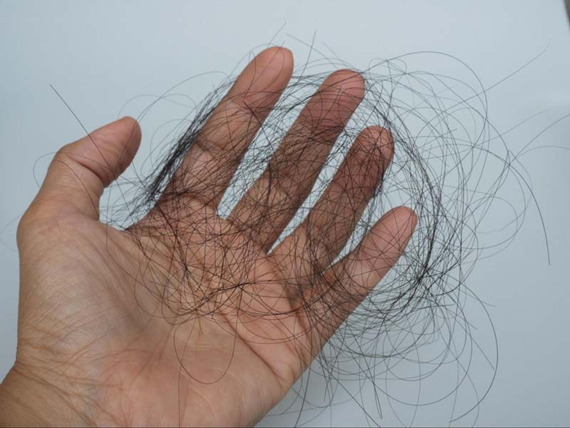 điều trị rụng tóc bằng Đông y y duoc thai nguyen