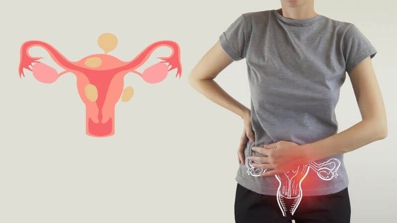 dấu hiệu viêm lộ tuyến cổ tử cung y duoc thai nguyen