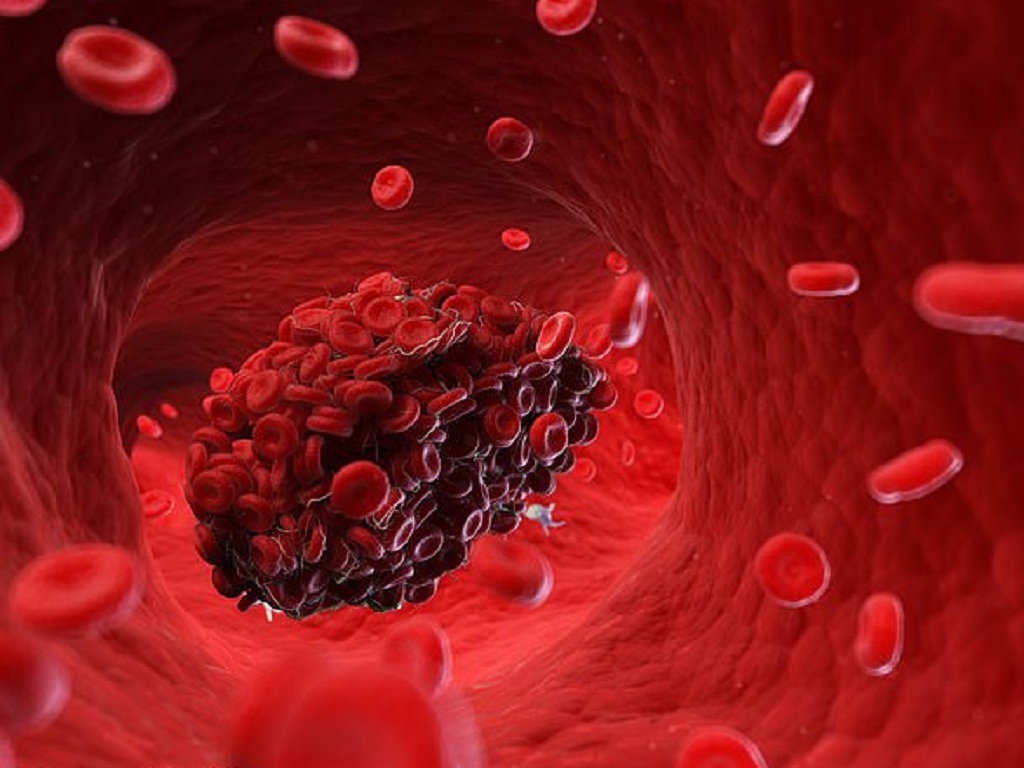 nguy cơ hình thành cục máu đông do đi ngồi máy bay tàu xe y duoc thai nguyen