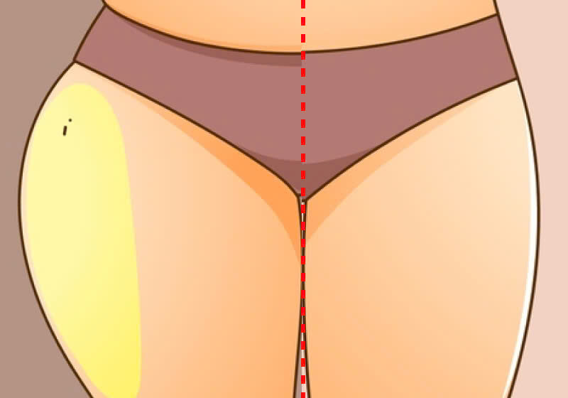 mông đùi to chống ung thư y duoc thai nguyen