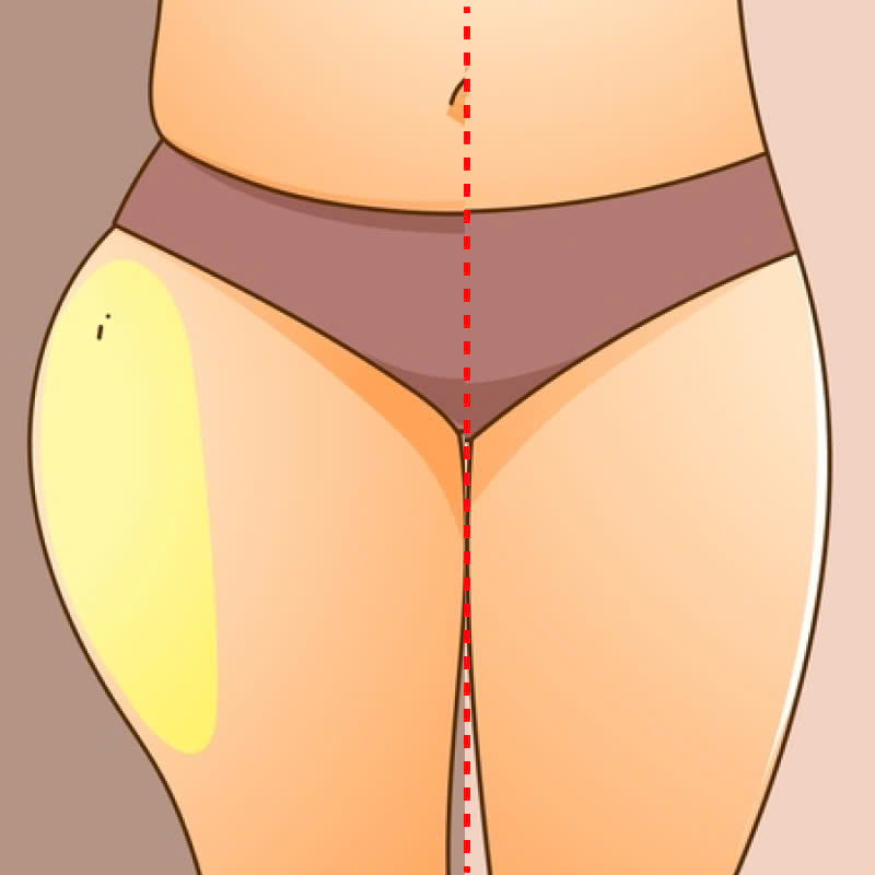 mông đùi to chống ung thư y duoc thai nguyen